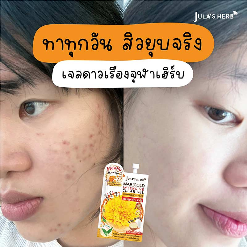 Jula Herb เจลลดสิวดอกดาวเรือง Marigold Intensive Clear Gel 8 มล. สูตรใหม่ (6ซอง)