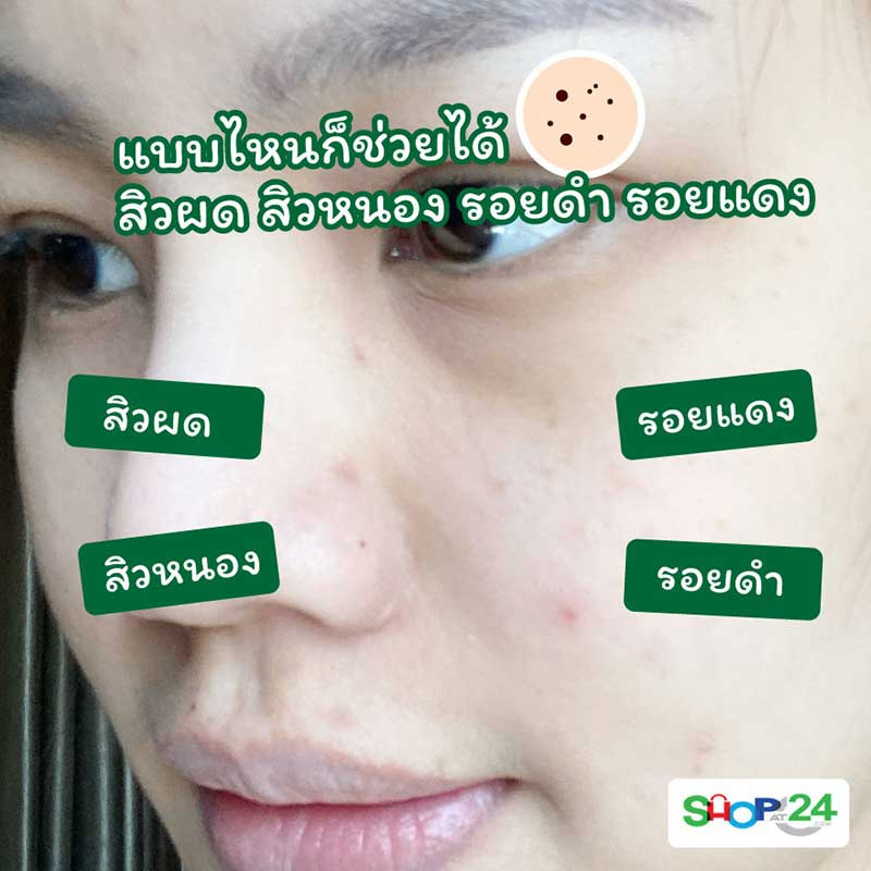 The Original เซรั่มบำรุงผิวหน้า Premium CICA Acne Serum Gel 10 กรัม (แพ็ก 6 ชิ้น)