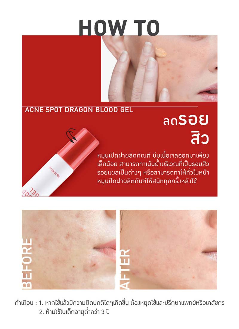 Baby Bright เจลบำรุงผิวหน้า Acne Spot Dragon Blood Gel 15 กรัม