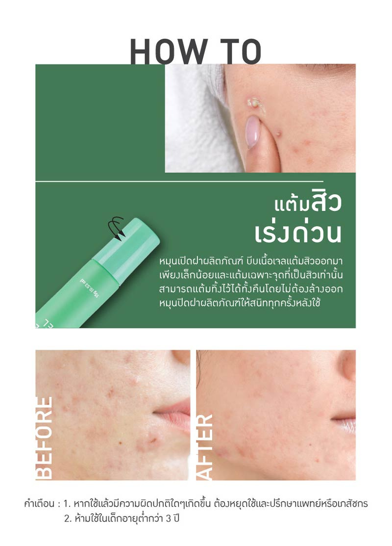 Baby Bright เจลบำรุงผิวหน้า Clear Acne Gel 15 กรัม