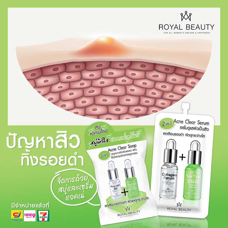 Royal Beauty เซรั่มบำรุงผิวหน้า Acne Clear Serum 8 กรัม (แพ็ก 6 ชิ้น)