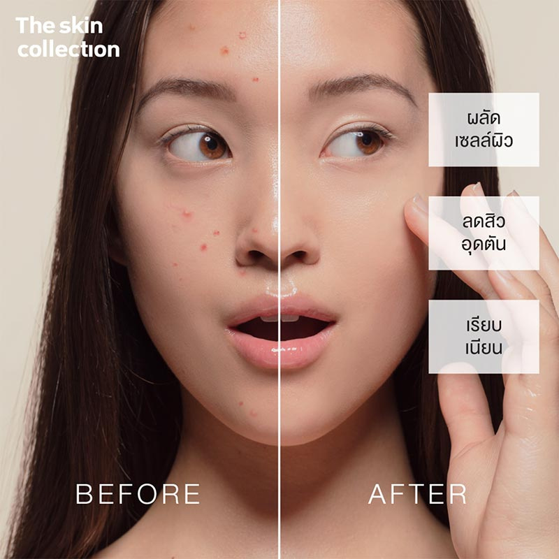 The Skin Collection เซรั่มดูแลผิวหน้า Serum AHA10% + BHA2% 30 มล.