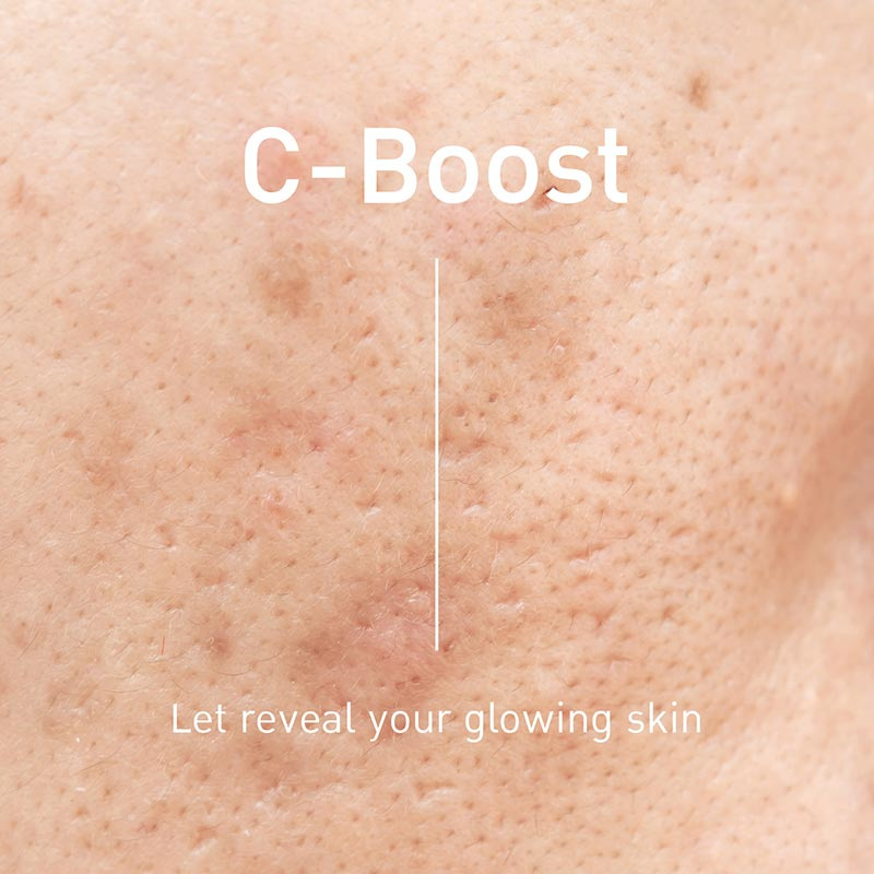 The Skin Collection เซรั่มดูแลผิวหน้า C-BOOST Serum 30 มล.