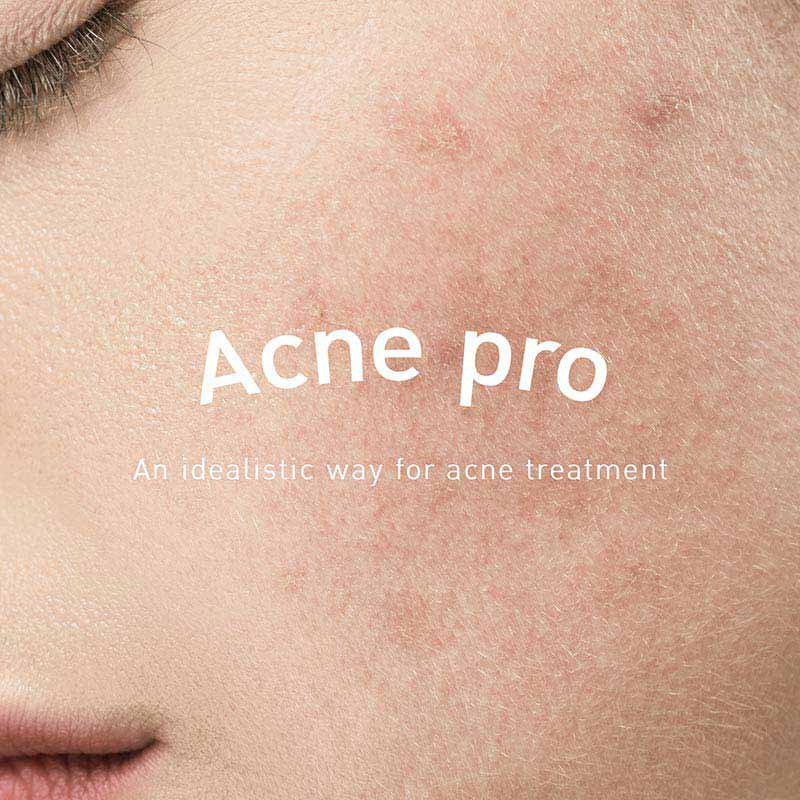 The Skin Collection เซรั่มดูแลผิวหน้า Acne Pro Serum 30 มล.