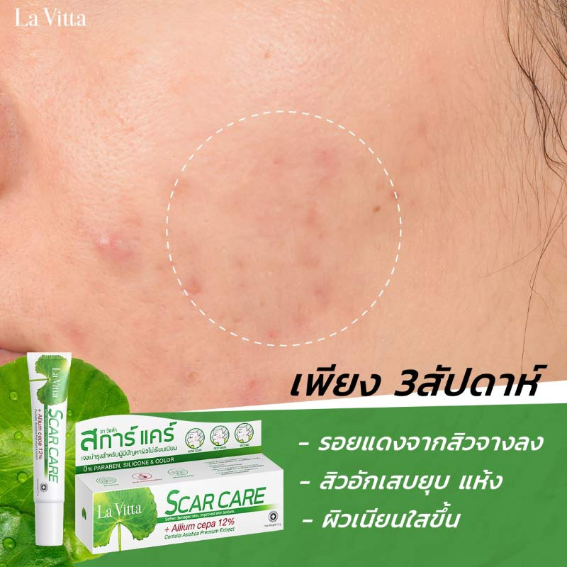 La Vitta เจลลดเลือนรอยแผล Scar care 5 กรัม