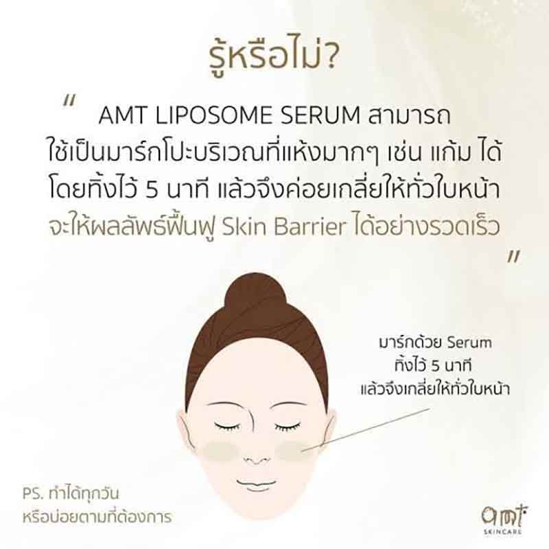 AMT AMT