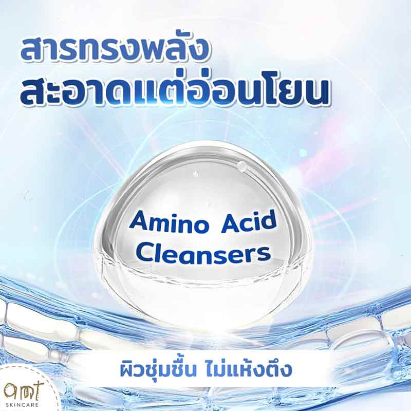 AMT