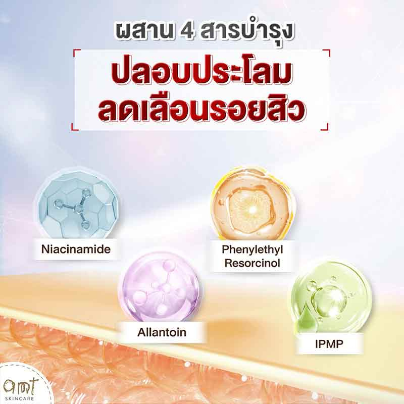 AMT