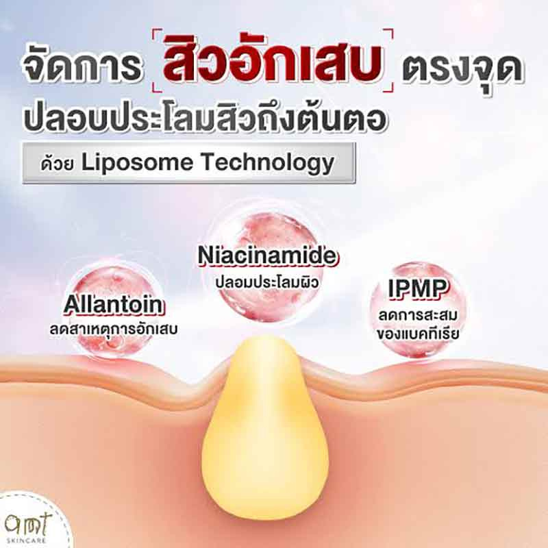 AMT
