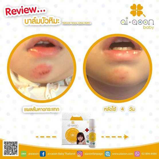 ai+aoon บาล์มบัวหิมะ ai+aoon บาล์มบัวหิมะ