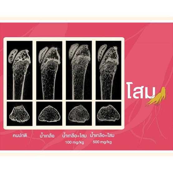 Herb Plus Lekcapp Gold (เลคแคปป์ โกล) แพ็ค 2 กล่อง Herb Plus Lekcapp Gold (เลคแคปป์ โกล) แพ็ค 2 กล่อง